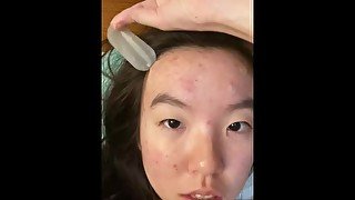 acne peel :)