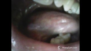 dentacci orridi