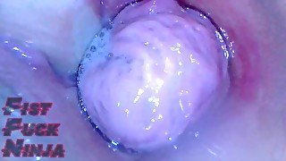 Juicy Japanese pussy endoscope view