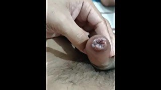 Syphilis (sexual transmitted disease) made my dick looking swallen. look at it