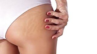 stretchmark therapy cream