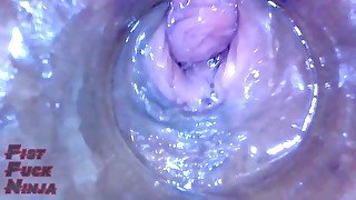 Inside pussy of beautiful Japanese milf (endoscope)