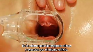 VAGINAL MASSAGE TECHNIQUES (Subtitulos En Espanol)