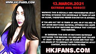Hotkinkyjo anal balls insertions with fisting & stuck ball prolapse HKJFANS