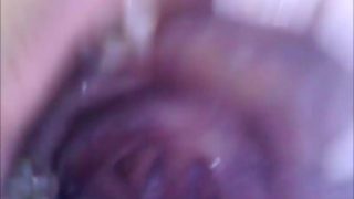 Live cam recording inside a vagina