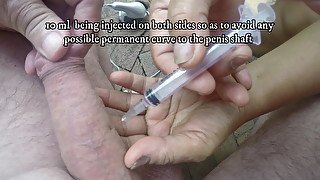 Injection  gives a rock-hard erection