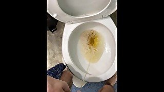 Guy with cerebral palsy pees straight into the toilet