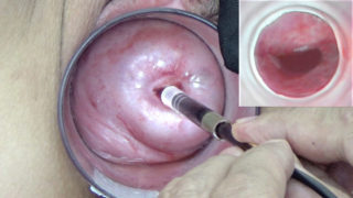 Mature Wife Cervix Playing with Endoscope Japanese Cam into Uterus